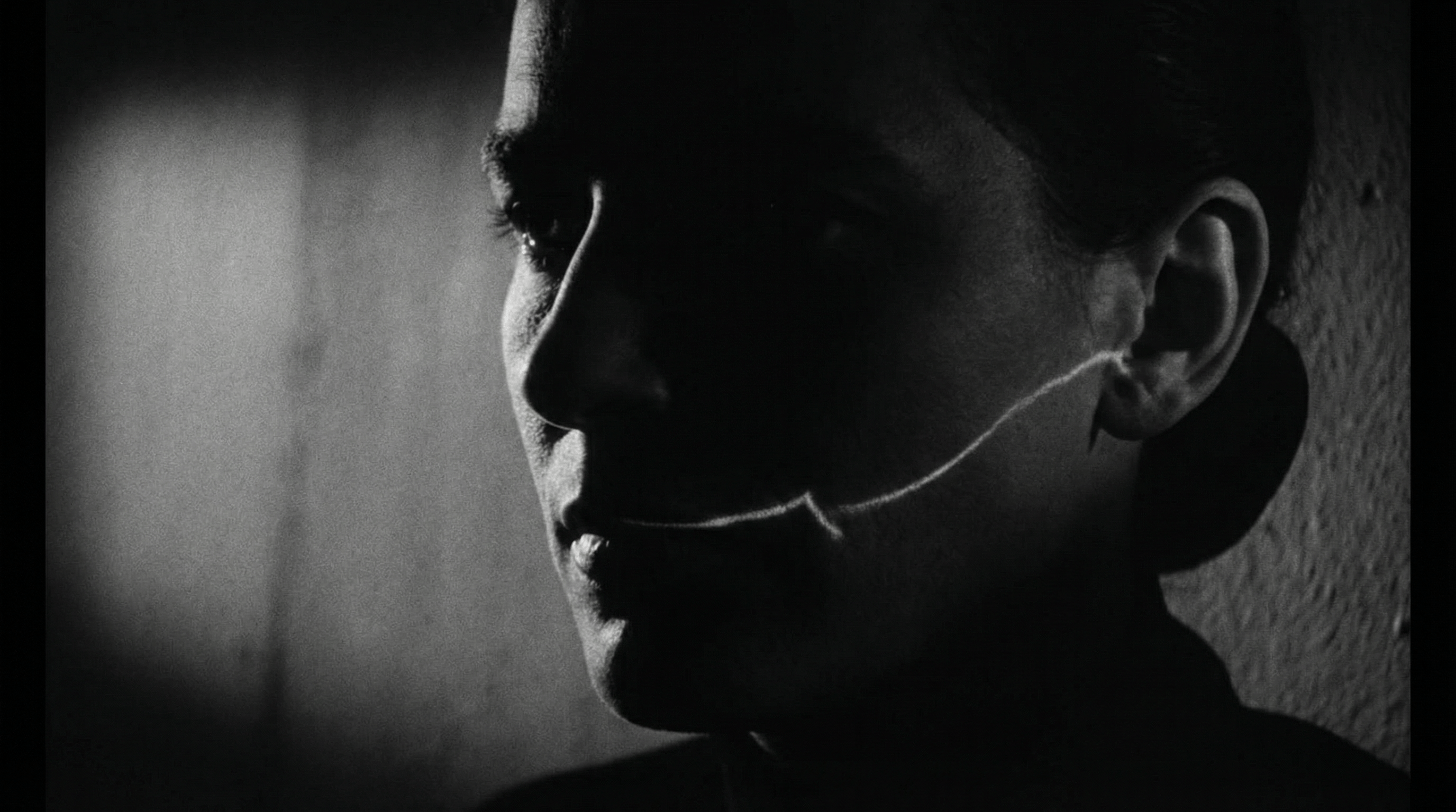 What Does the Glasgow Smile Mean? 2 What Does the Glasgow Smile Mean?