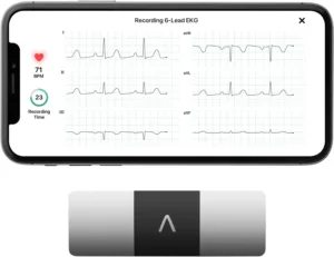 KardiaMobile 6-Lead Personal EKG Monitor – Six Views of The Heart – Detects AFib and Irregular Arrhythmias – Instant Results in 30 Seconds – Works with Most...